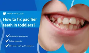 Close-up of a toddler's mouth showing misaligned teeth, likely due to pacifier use. Text discusses fixing pacifier teeth with orthodontic treatments.